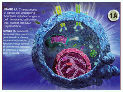 C&aacute;ncer Fucoid&aacute;n