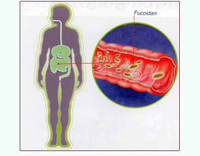 C&aacute;ncer Fucoid&aacute;n